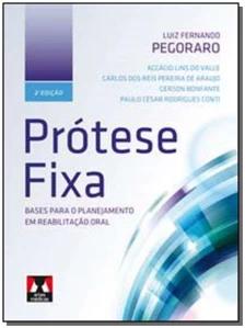 Prótese Fixa